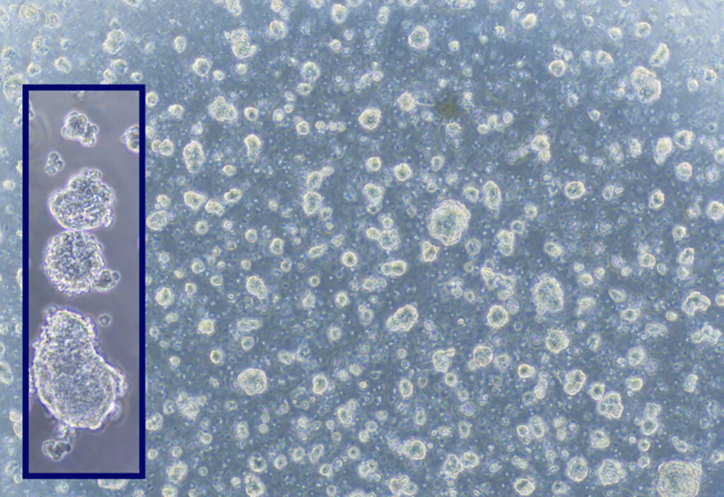 cultivated meat cell density